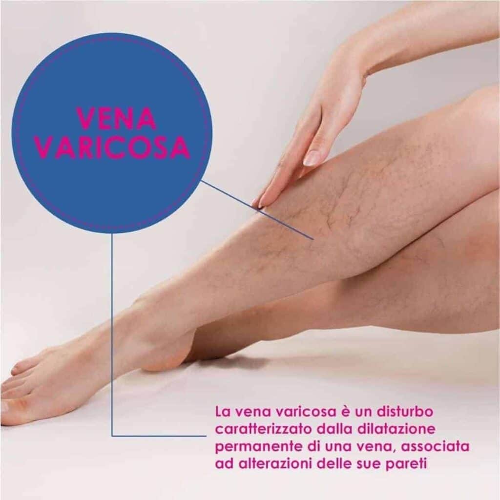 CREMA-VENE-VARICOSE-E-CAPILLARI-4-min.jpg